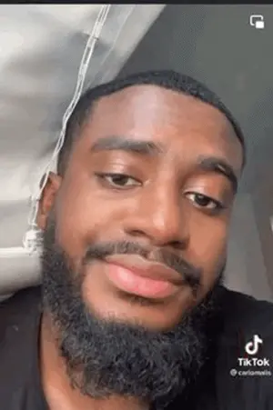 A Man With A Beard Is Making A Funny Face While Looking At The Camera .